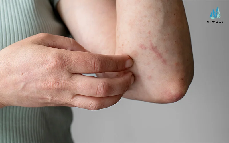 a person experiencing allergies because of poor air quality